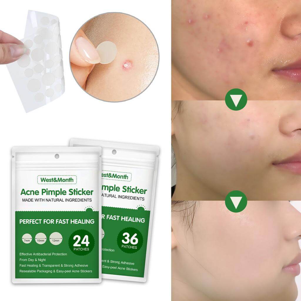 Hydrocolloid Pimple Patches