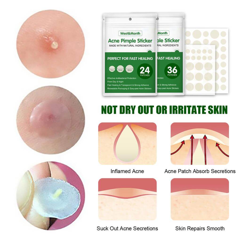 Hydrocolloid Pimple Patches
