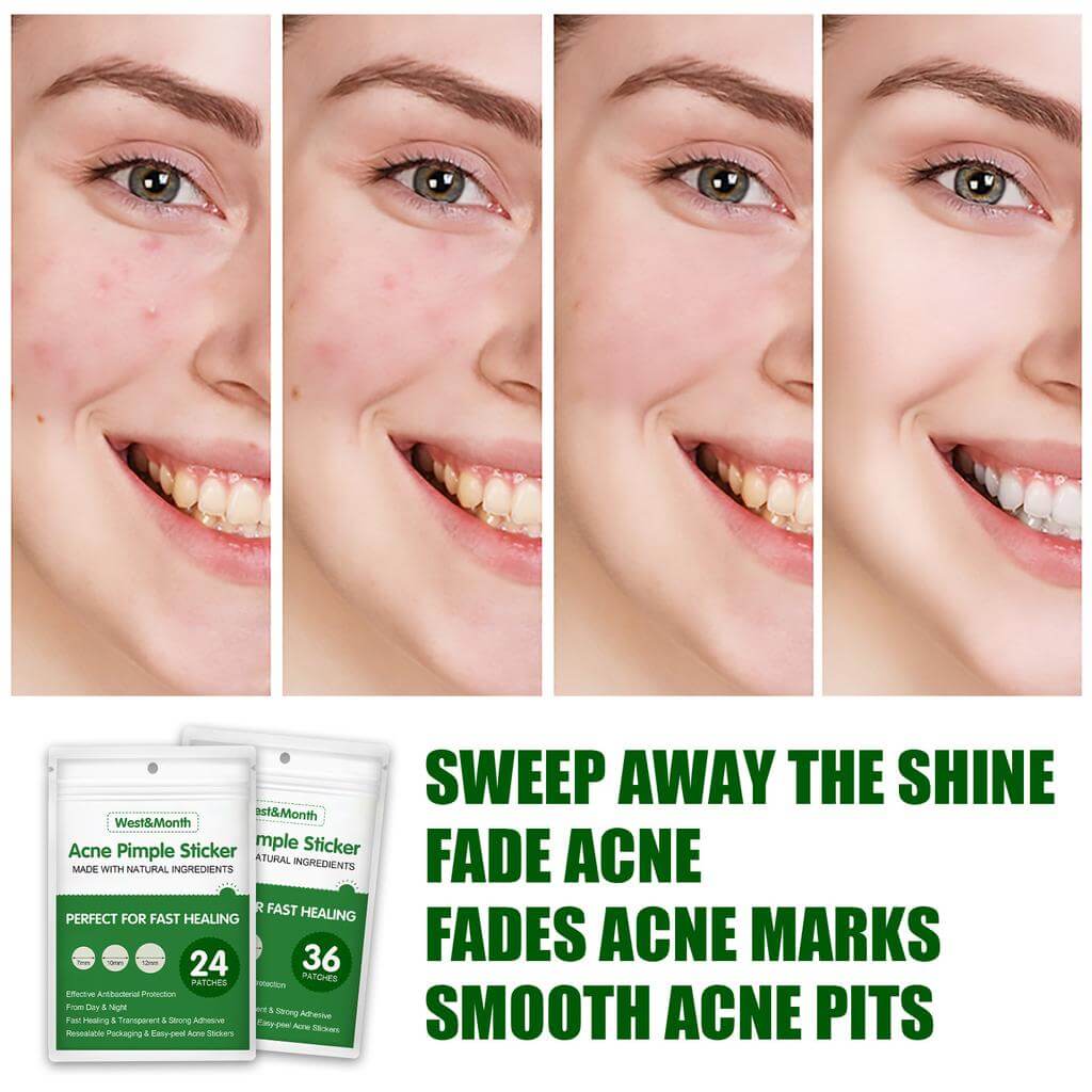 Hydrocolloid Pimple Patches