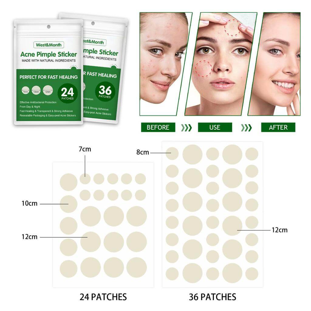 Hydrocolloid Pimple Patches